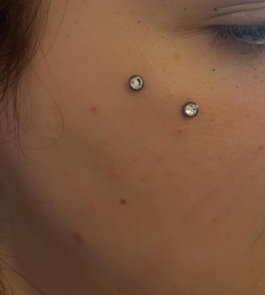 Dermal piercing by professional piercer, Ottawa ON